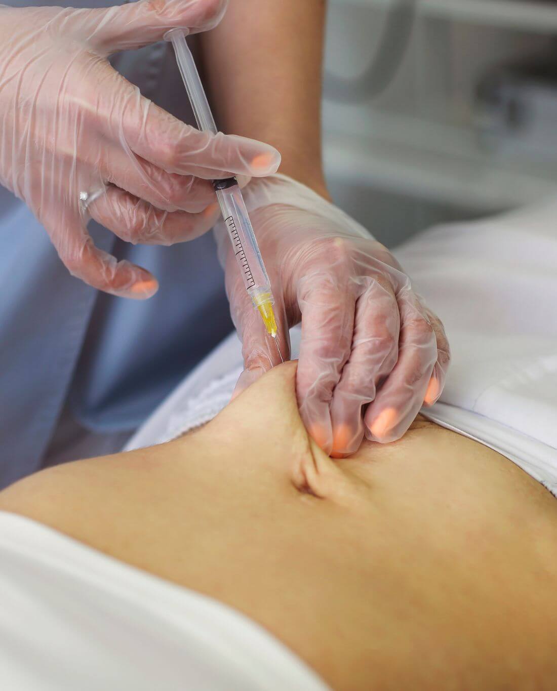 An image of a woman's abdomen having a Semaglutide treatment injected into it. 